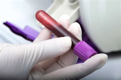 New Blood Test To Detect Heart Attacks Faster Medtechasia