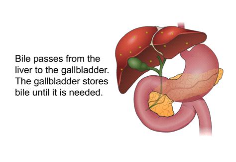 Cholecystectomy Open And Laparoscopic