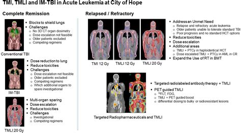 Frontiers Total Marrow Irradiation Tmi Addressing An Unmet Need In