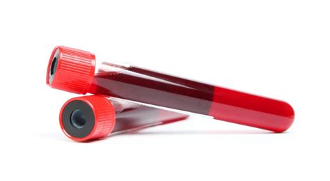 Behind The Scenes Of Blood Testing