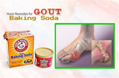 37 Home Remedies For Gout In Hands And Feet