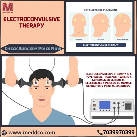 Electroconvulsive Therapy Procedure