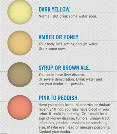 Heres What The Color Of Your Urine Says About Your Health Color Urinal Liver Disease