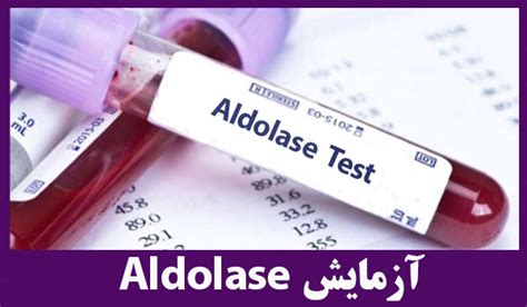 آزمایش آلدولاز aldolase آزمایشگاه پاتوبیولوژی صبا