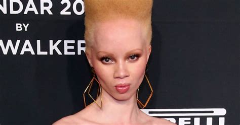 Afrykańska Modelka Która Jest Albinoską Pierwszy Raz Pojawiła Się Na Okładce Voguea Ofeminin