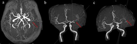 J Med Cases