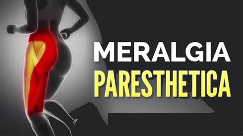How To Cure Meralgia Paresthetica Internaljapan9
