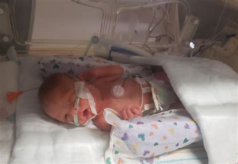Little Guy Has Arrived At 27 Weeks After 6 Uncertain Weeks In Hospital