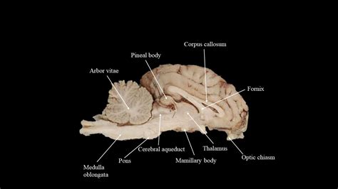 Sheep Brain Atlas Of Comparative Vertebrate Anatomy