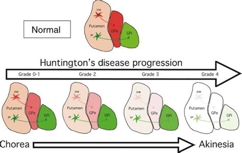 Cureus The Effect Of Huntingtons Disease On The Basal Nuclei A Review