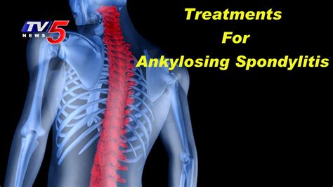 Causes Symptoms And Treatments For Ankylosing Spondylitis Kims