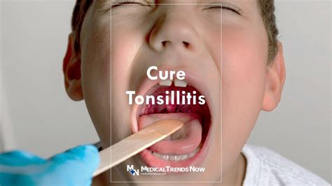How To Cure Tonsillitis 7 Little Known Secrets Medical Trends Now