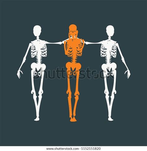 Human Skeleton Standing Hugging Halloween Party Stock Vector Royalty