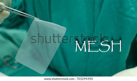 Synthetic Mesh Inguinal Hernia Repair Stock Photo 703294390 Shutterstock