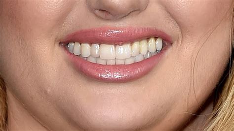 Can You Guess The Aussie Celeb From Their Smile Youtube