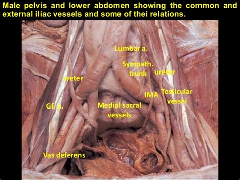 Four distinct pairs of abdominal muscles create the flat anterolateral abdominal wall. Lower Abdomen Anatomy Male