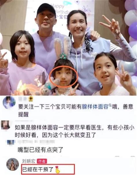 霍思燕否認嗯哼是腺樣體面容！劉畊宏兒女和伊能靜兒女症狀明顯 每日頭條