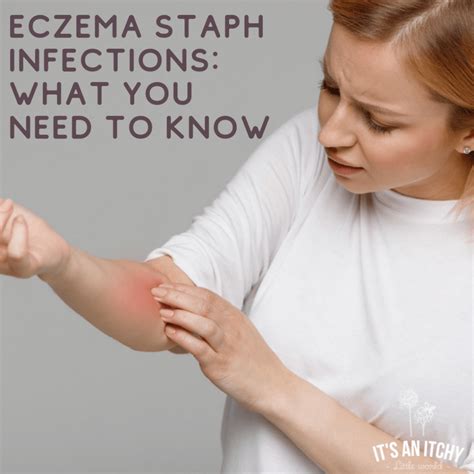 3 Types Of Eczema Staph Infections To Be Aware Of