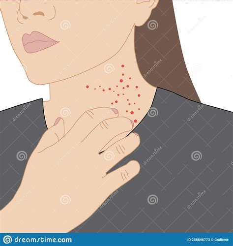 Women Scratch The Rash Neck Itch Because Of Allergies Symptoms Or