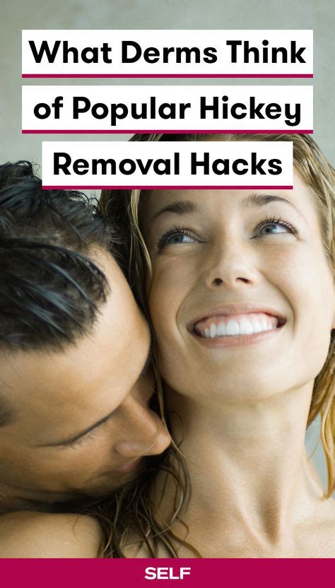 9 Of The Most Popular Hickey Removal Hacks—and What Dermatologists
