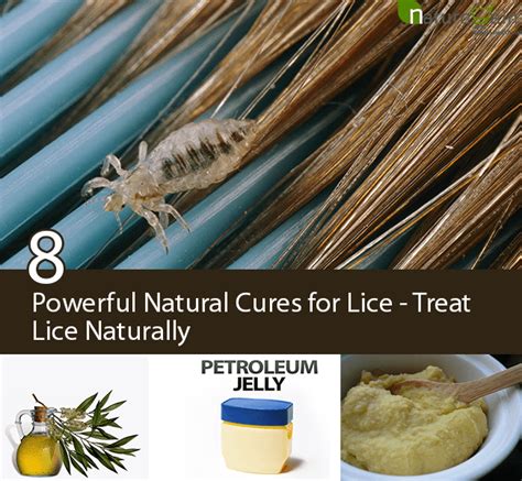 8 Powerful Natural Cures For Lice Treat Lice Naturally