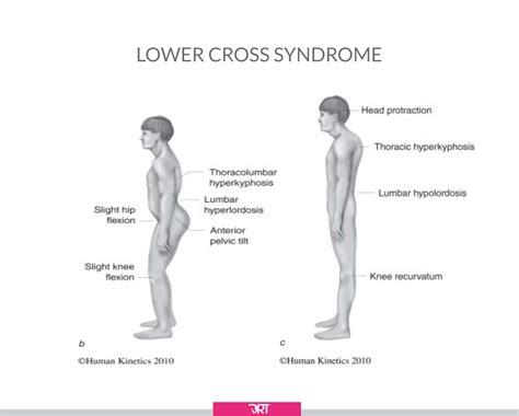 Lower Cross Syndrome In Dressage Riders