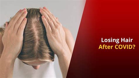 Top Image Covid Hair Loss Treatment Thptnganamst Edu Vn