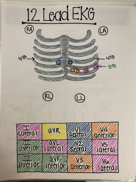 Printable Lead Ekg Interpretation Cheat Sheet