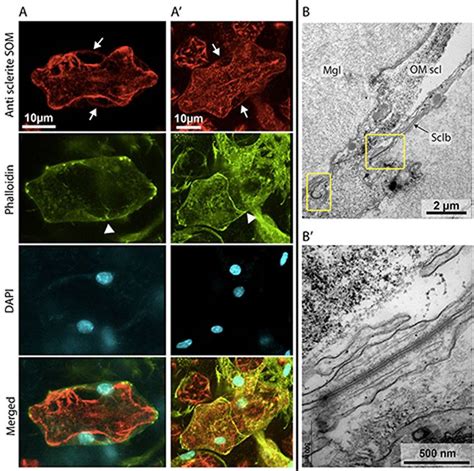 Observation Of Growing Sclerites And Their Cellular Environment By