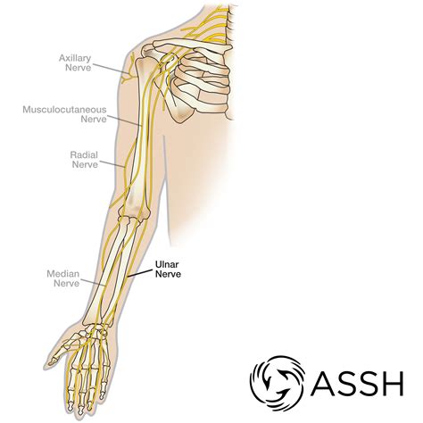 The Ulnar Nerve Is Just One Of The Peripheral Nerves In The Arm Radial Nerve Body Anatomy