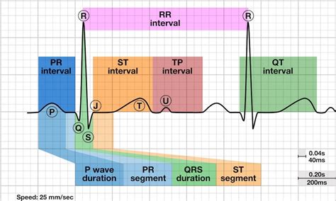 QT Interval LITFL ECG Library Basics