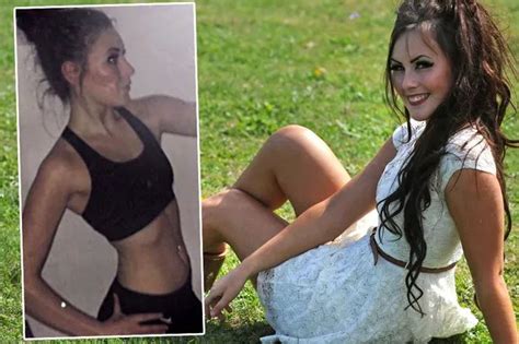 Teenager Who Survived On Just One Banana A Day Beats Anorexia To Become