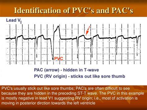 Ppt Electrocardiogram Powerpoint Presentation Free Download Id5229956