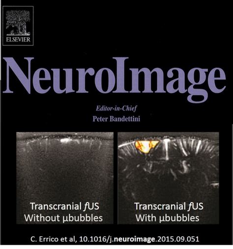 Ultrasound is sound that travels through soft tissue and fluids, but it bounces back, or echoes, off denser surfaces. New Article in Neuroimage : Functional Ultrasound becomes ...