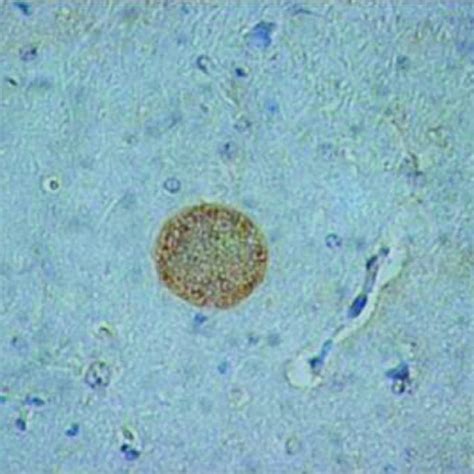 1 Toxoplasma Gondii Oocysts In A Cat Stool Sample Note Three
