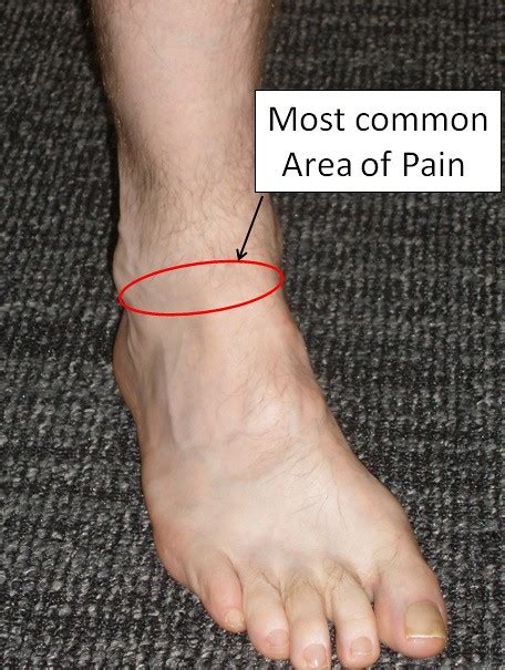 Foot Pain Under Ankle The Complete Diagnosis And Treatment Guide