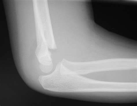 UCSD Musculoskeletal Radiology