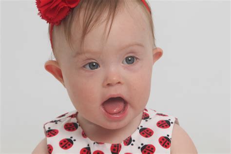 Technically speaking, parents and doctors look for signs of down syndrome, rather than symptoms. A mother's story of Down syndrome: "I didn't know I would ...
