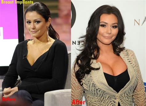 jenni jwoww farley breast implants plastic surgery before and after boobs job 2018 plastic