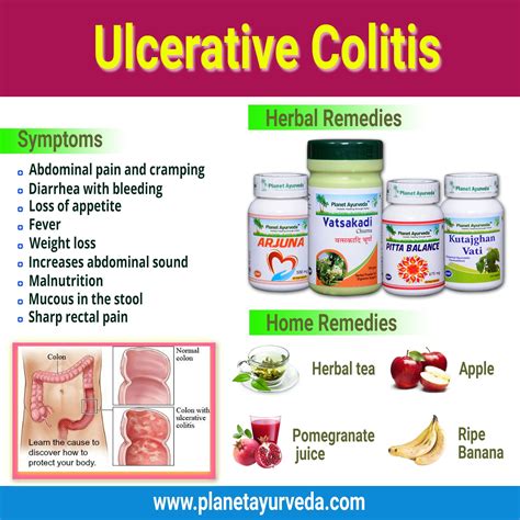 Natural Remedies For Colitis