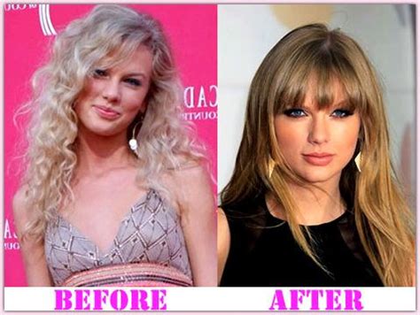 Taylor Swift Plastic Surgery Nose Augmentation Before And ...