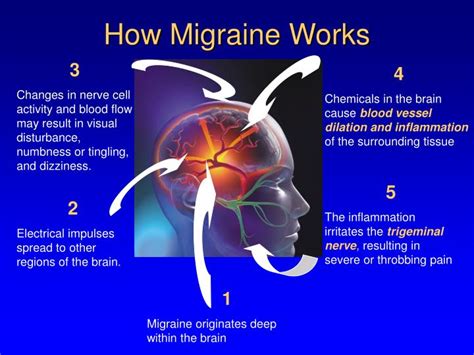 Look at her and if how does botox work for migraines how does botox work at the neuromuscular junction does botox work how long does it take botox to work how. PPT - What You Can Do For Your Migraine Headaches ...