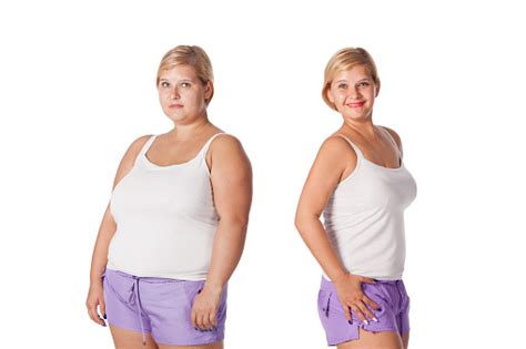 Before And After Weight Loss Stock Photo Download Image Now Istock