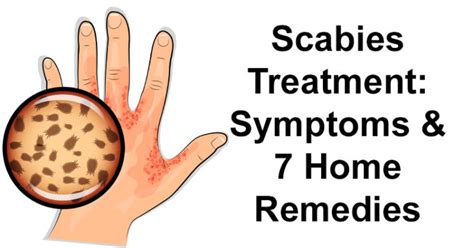 Scabies Treatment Symptoms And 7 Home Remedies David Avocado Wolfe