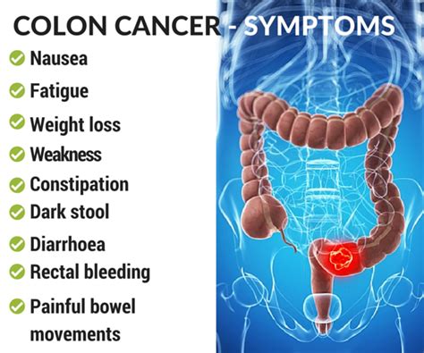 Symptoms Of Colon Cancer