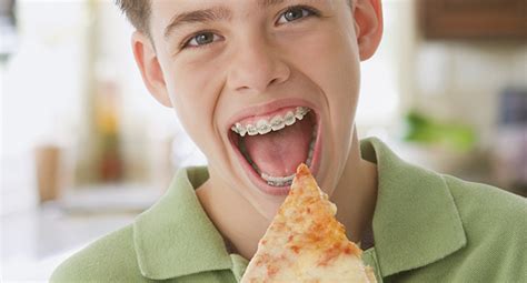 Explaining what you did to your orthodontist is embarrassing enough, let alone spending the time leading up to your emergency. EATING WITH BRACES: WHAT TO BE AWARE OF? - Orthosmile ...