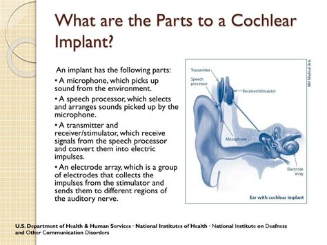 Ppt Cochlear Implants Powerpoint Presentation Free Download Id2363650