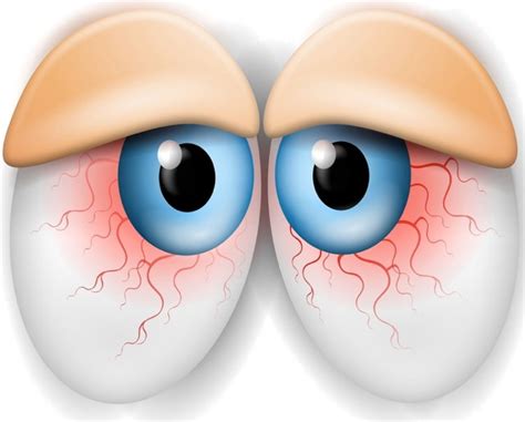 Cartoon Sleepy Eyes Very Tired Eyes Clipart Bodewasude