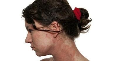 Common Skin Conditions At A Glance Healthgrades Com