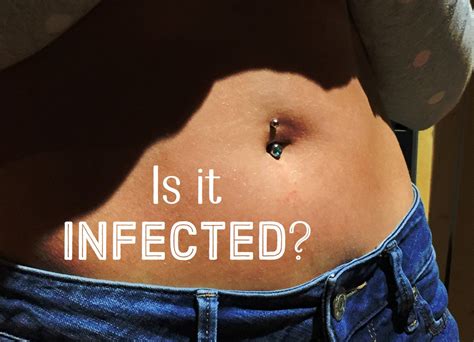 Is My Belly Button Piercing Infected Infected Belly Button Belly